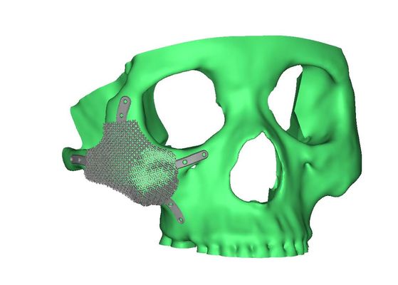 Medical 3D reconstruction and 3D printing services