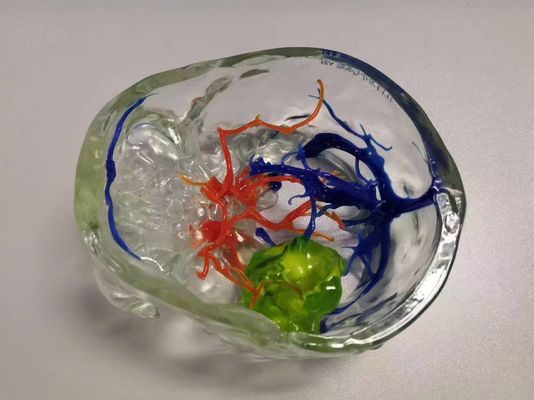 Medical 3D reconstruction and 3D printing services