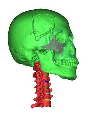 Medical 3D reconstruction and 3D printing services