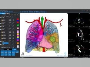 บริการสร้างใหม่ 3D และพิมพ์ 3D